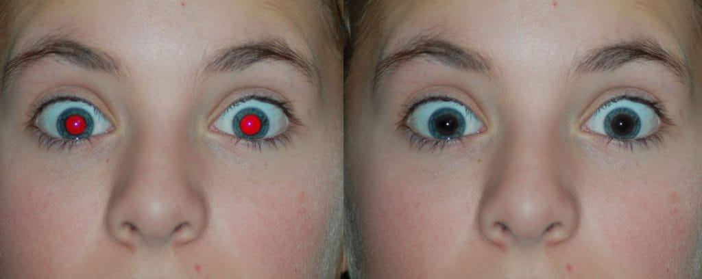 Redeye Photo Correction